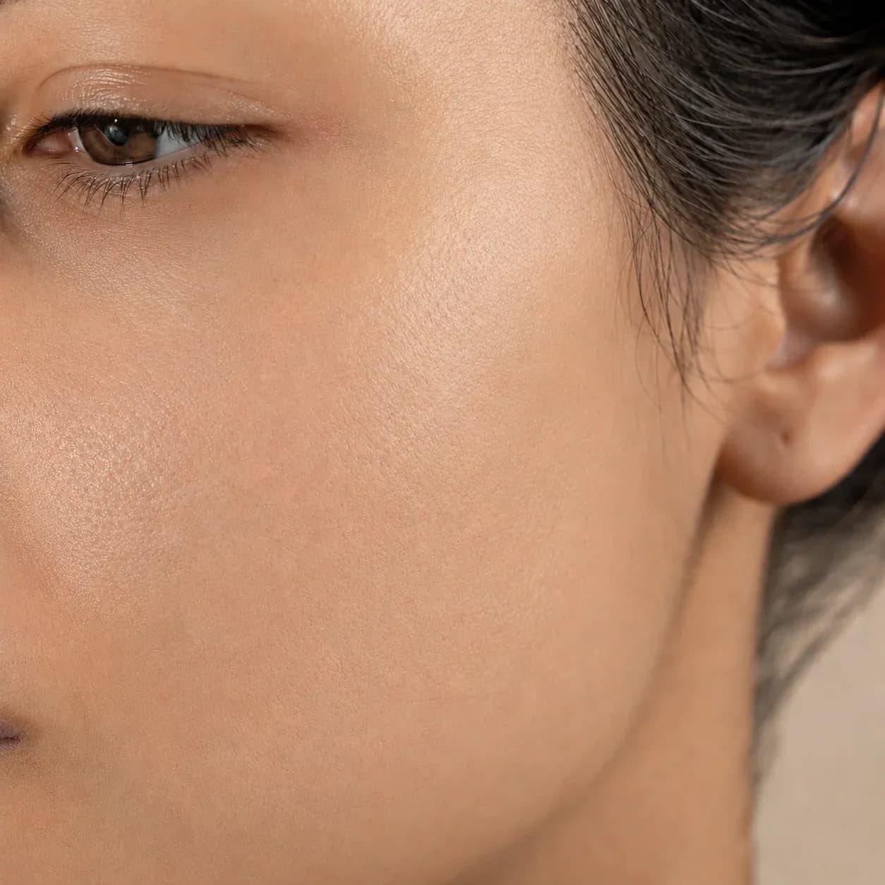 Microneedling